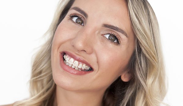 Ortodoncia para adultos en valencia