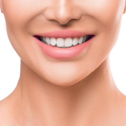 Beneficios de ortodoncia